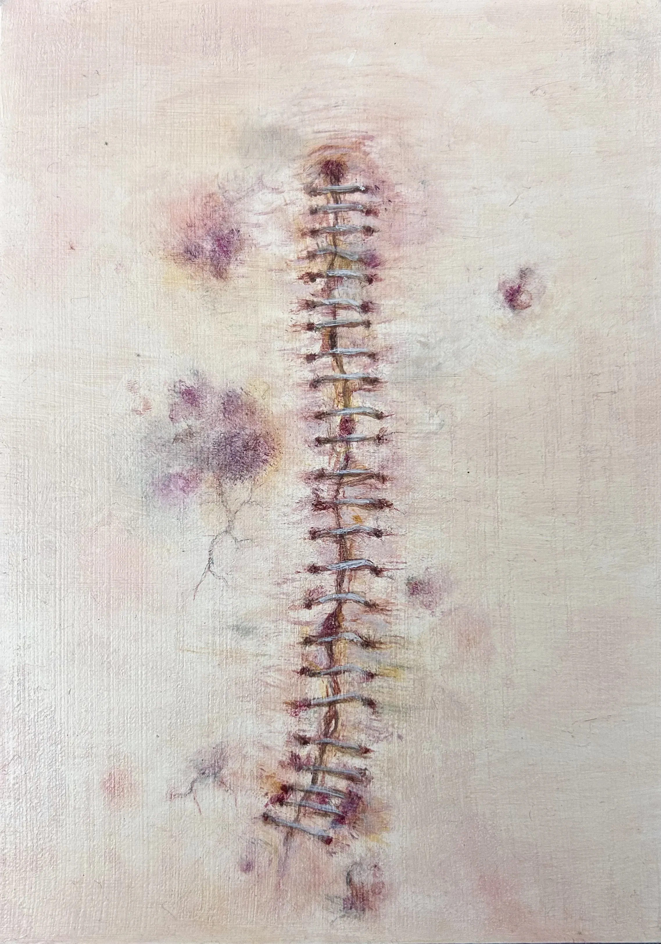 incision-2026-oil